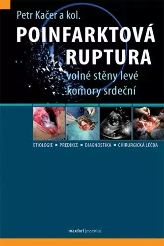 Aktuální Poinfarktová ruptura volné stěny levé komory srdeční