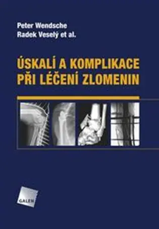 Vysoce Kvalitní Úskalí a komplikace při léčení zlomenin